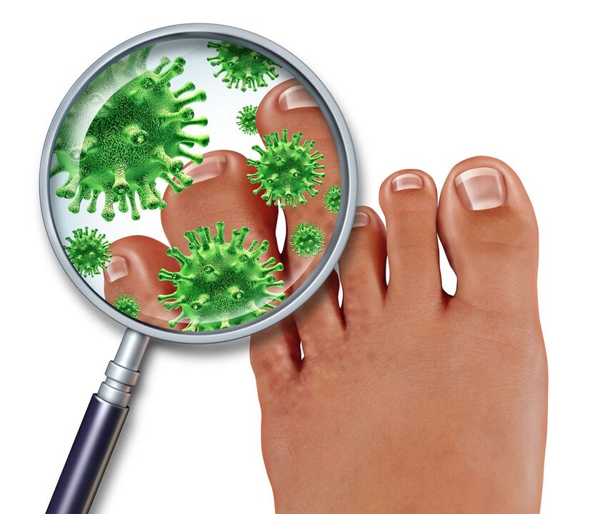 where does nail fungus come from