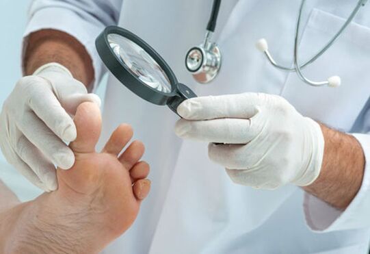 Fungus treatment