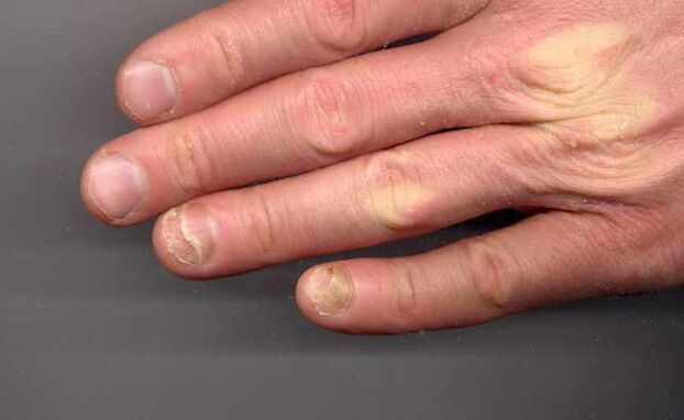 So in the hands